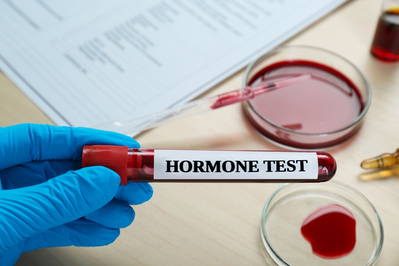 hormone testing